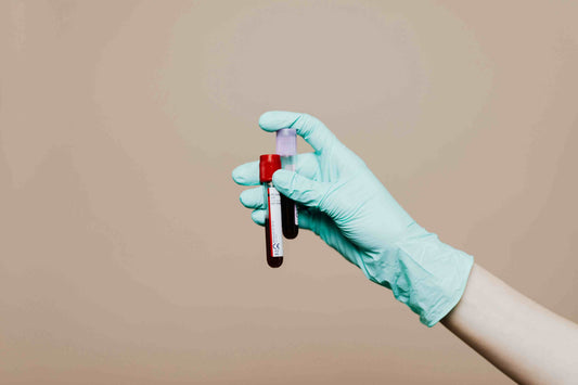 Diamine Oxidase Test Blood Sample