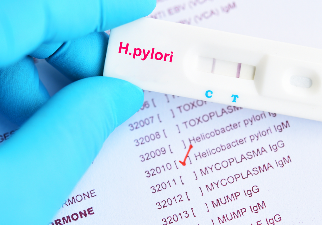 h. Pylori histamine intolerance helicobacter pylori test
